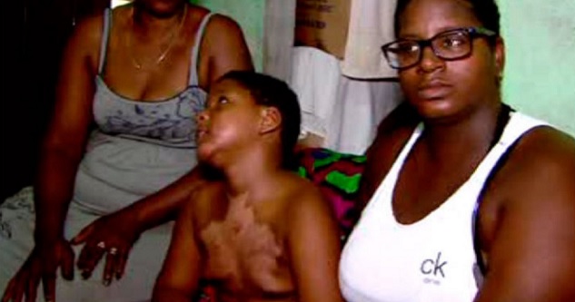 Menino de 7 anos tem corpo incendiado após usar perfume e brincar com isqueiro em Camaçari